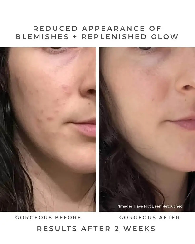 Earth Harbor Naturals OASIS Deep Pore Gel Cleanser: Chlorophyll + Botanical BHA