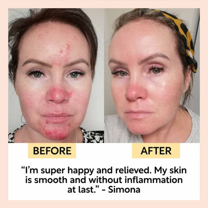 UpCircle Eco Anti-Aging Spa Night Cream with Hyaluronic Acid and Niacinamide