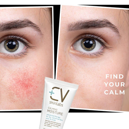 CV Skinlanbs Calming Moisture for Face-Neck-and-Scalp 2 oz